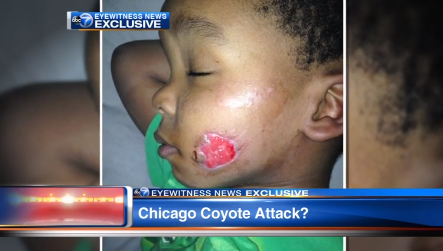 Read & React: Coyote Attacks Chicago Boy in City Park